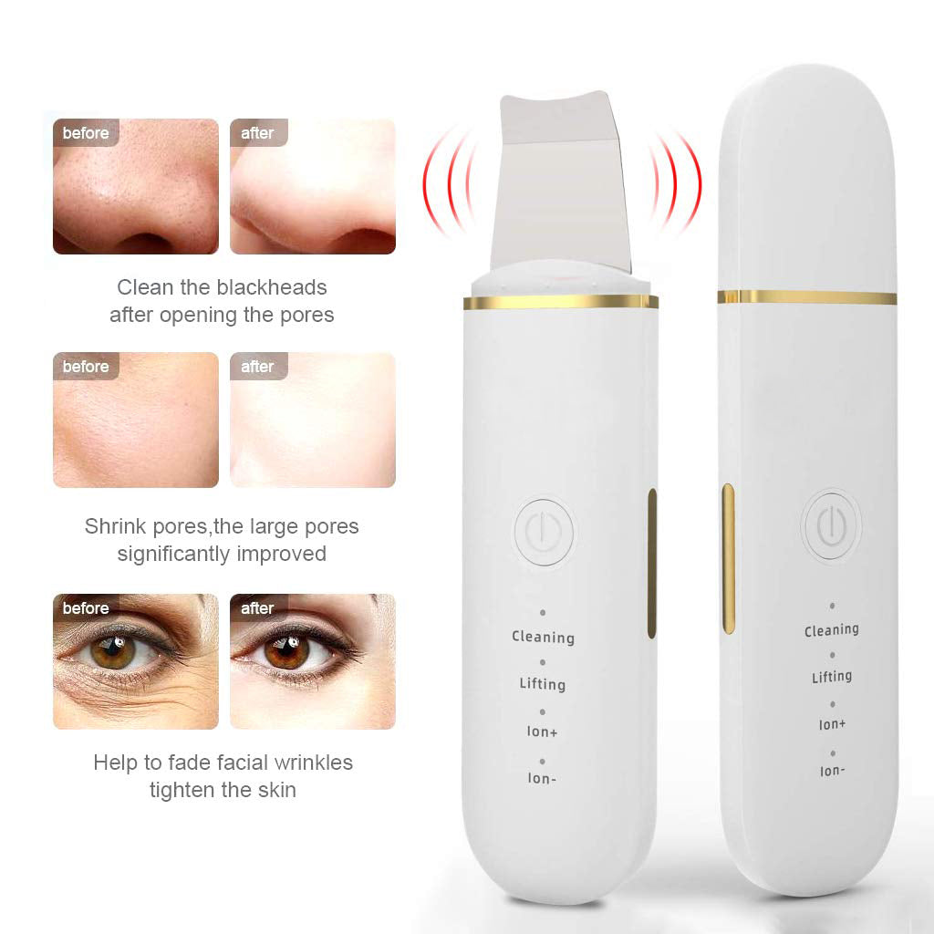 Electric blackhead pore remover