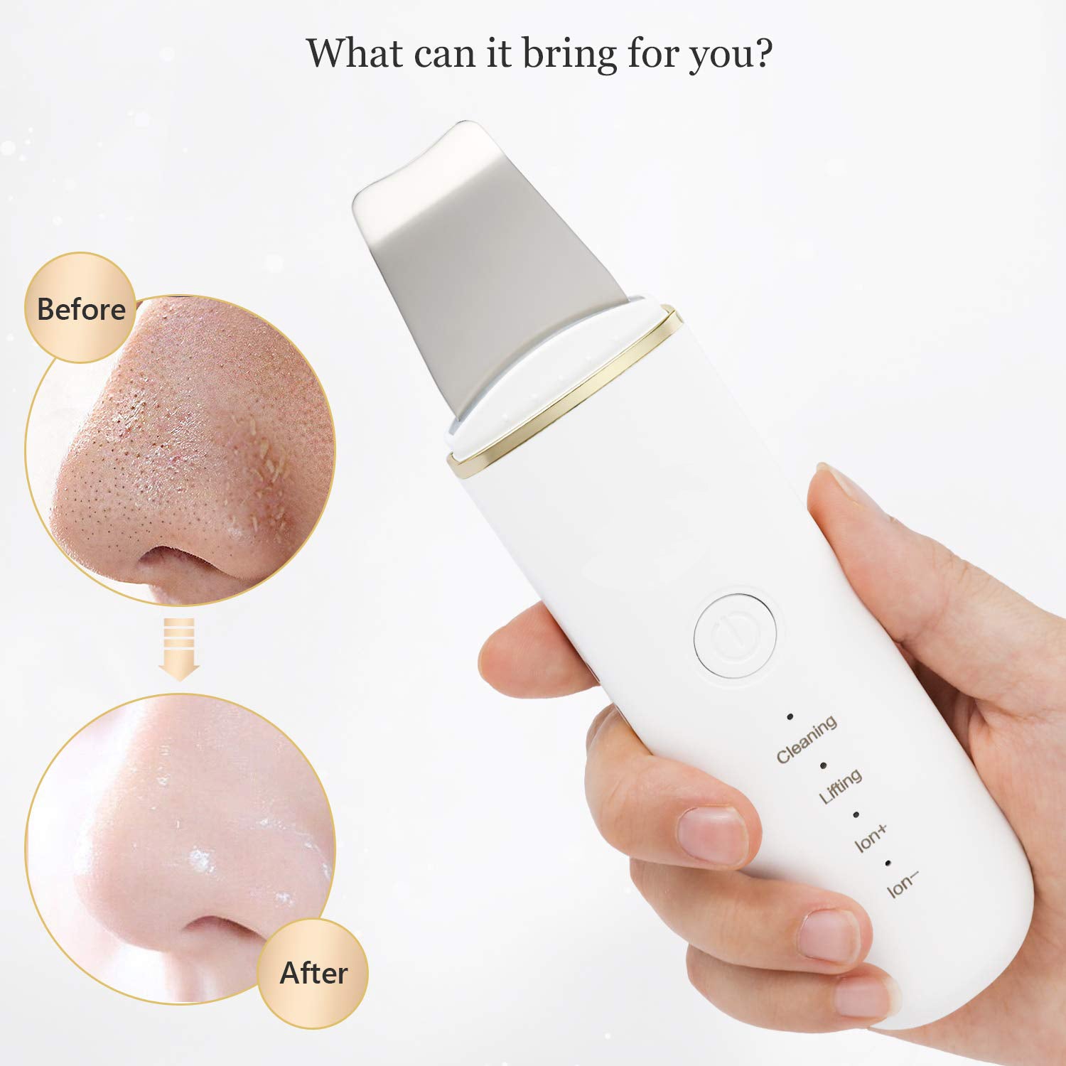 Electric blackhead pore remover
